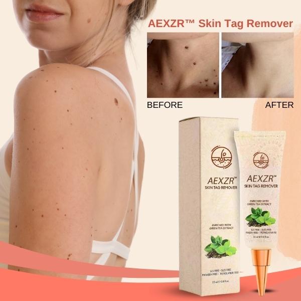 AEXZR™ Skin Tag Remover