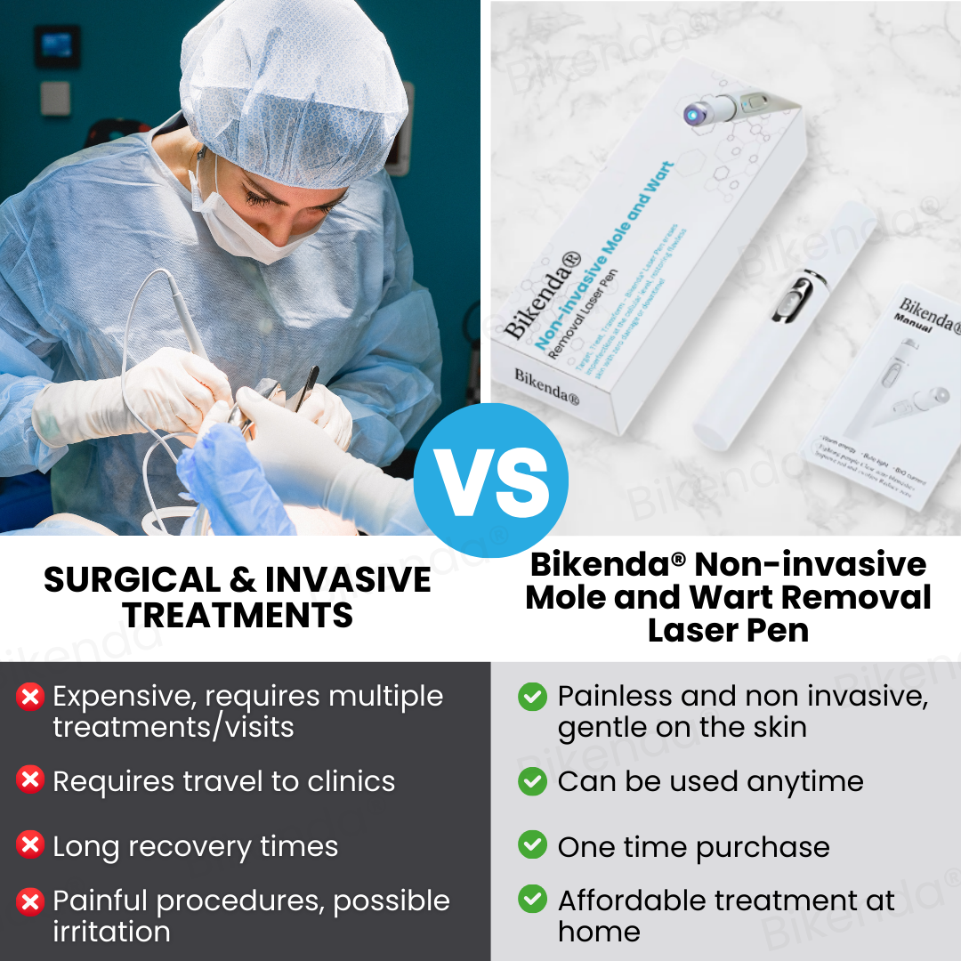Bikenda® Non-invasive Mole and Wart Removal Laser Pen