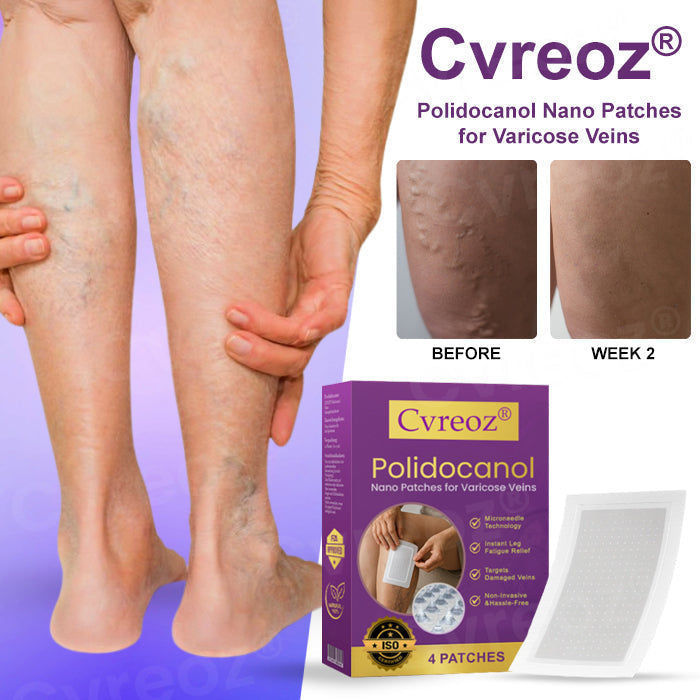 🔥Hot Sales - 50% OFF🔥Cvreoz® Polidocanol Nano Patches for Varicose Veins