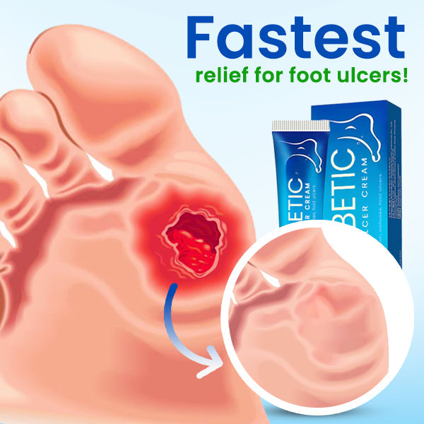 SootheStep™ Diabetic Foot Ulcer Cream