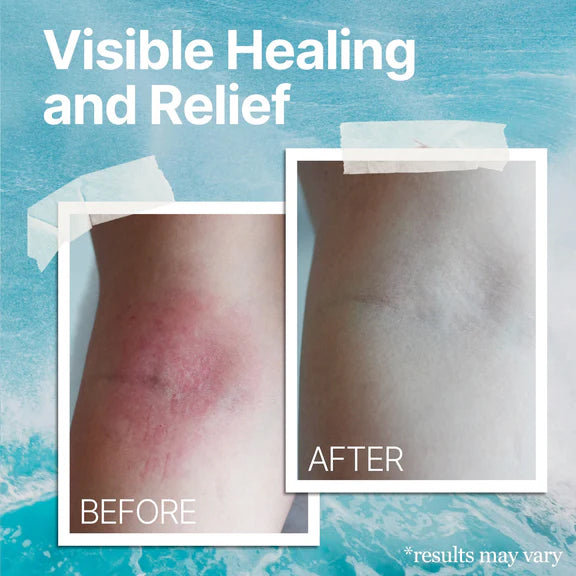 AEXZR™  Ocean Healed  Eczema Soothing Cream