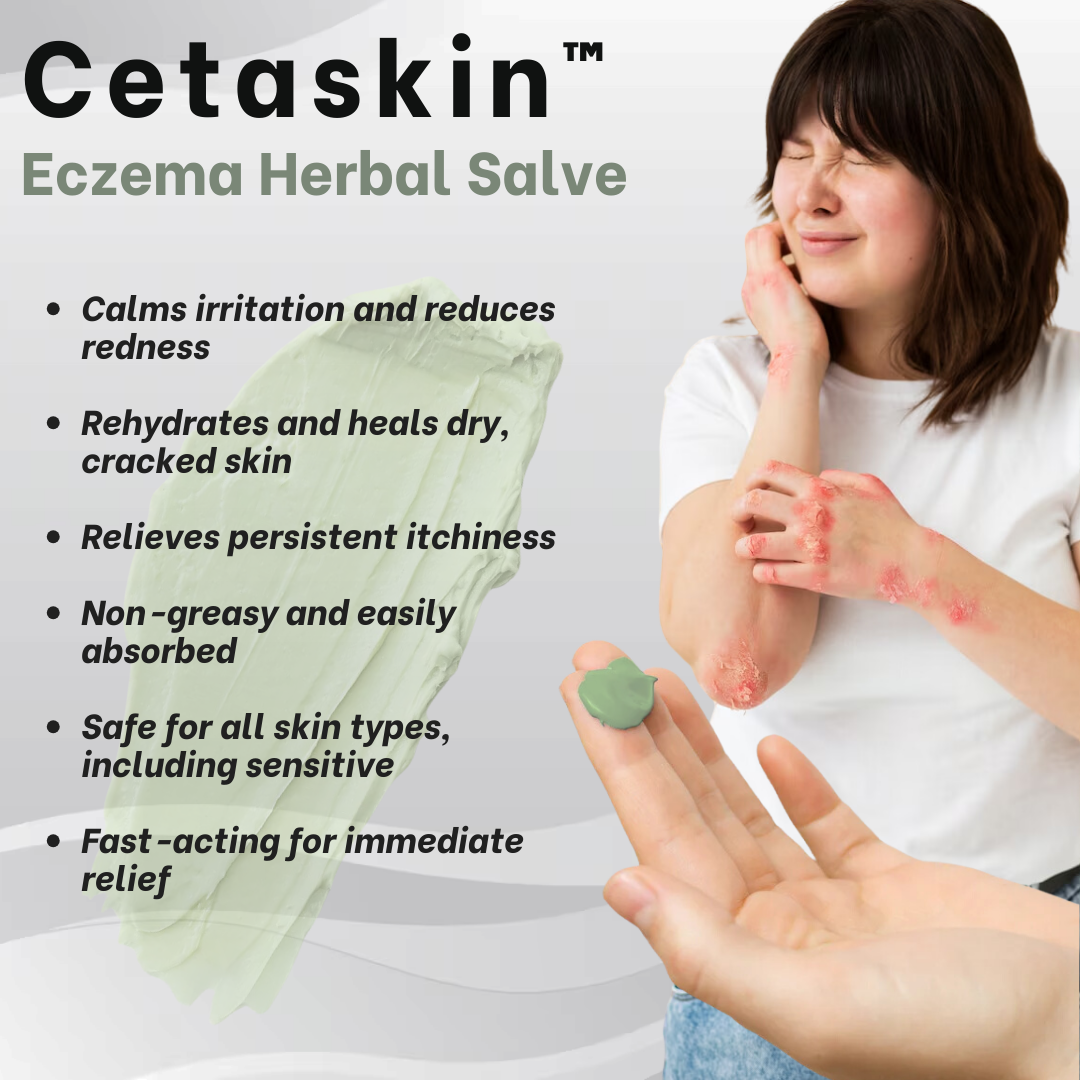 Cetaskin™ Eczema Herbal Salve