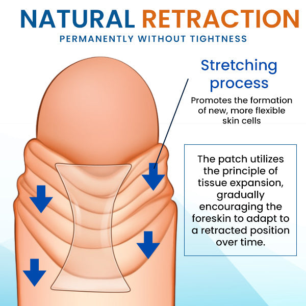 AEXZR™ Prepuce Correction Patch (40pcs)