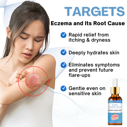 Eczirine™ Eczema Treatment Serum