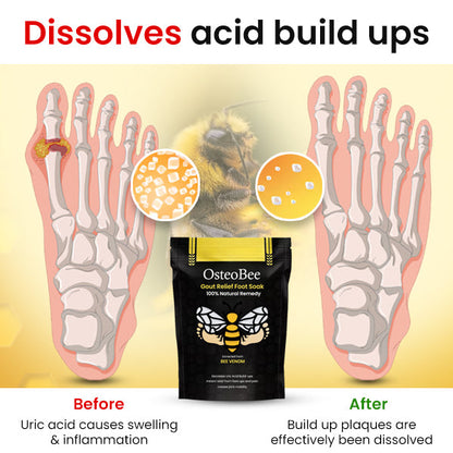 OsteoBee™ Gout Relief Foot Soak