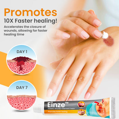 Einze™ Diabetic Wounds Treatment Cream