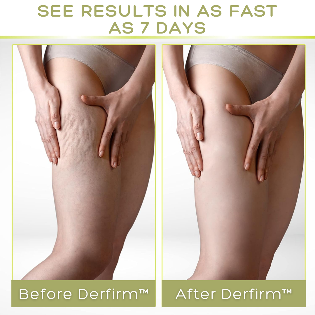 Derfirm™ Collagen Firming Body Cream