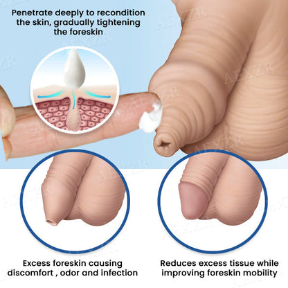 AEXZR™ Foreskin Cure & Glans Care Cream