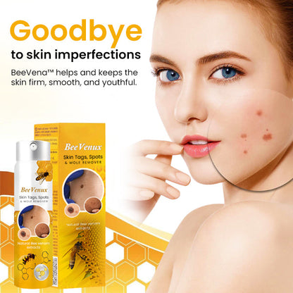 BeeVenux™ Skin Tags, Spots & Mole Remover