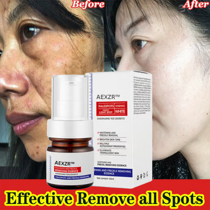 🔥 AEXZR™ Vitamin C Whitening Freckles Face Cream Remove Melasma Dark Spots Lighten Melanin