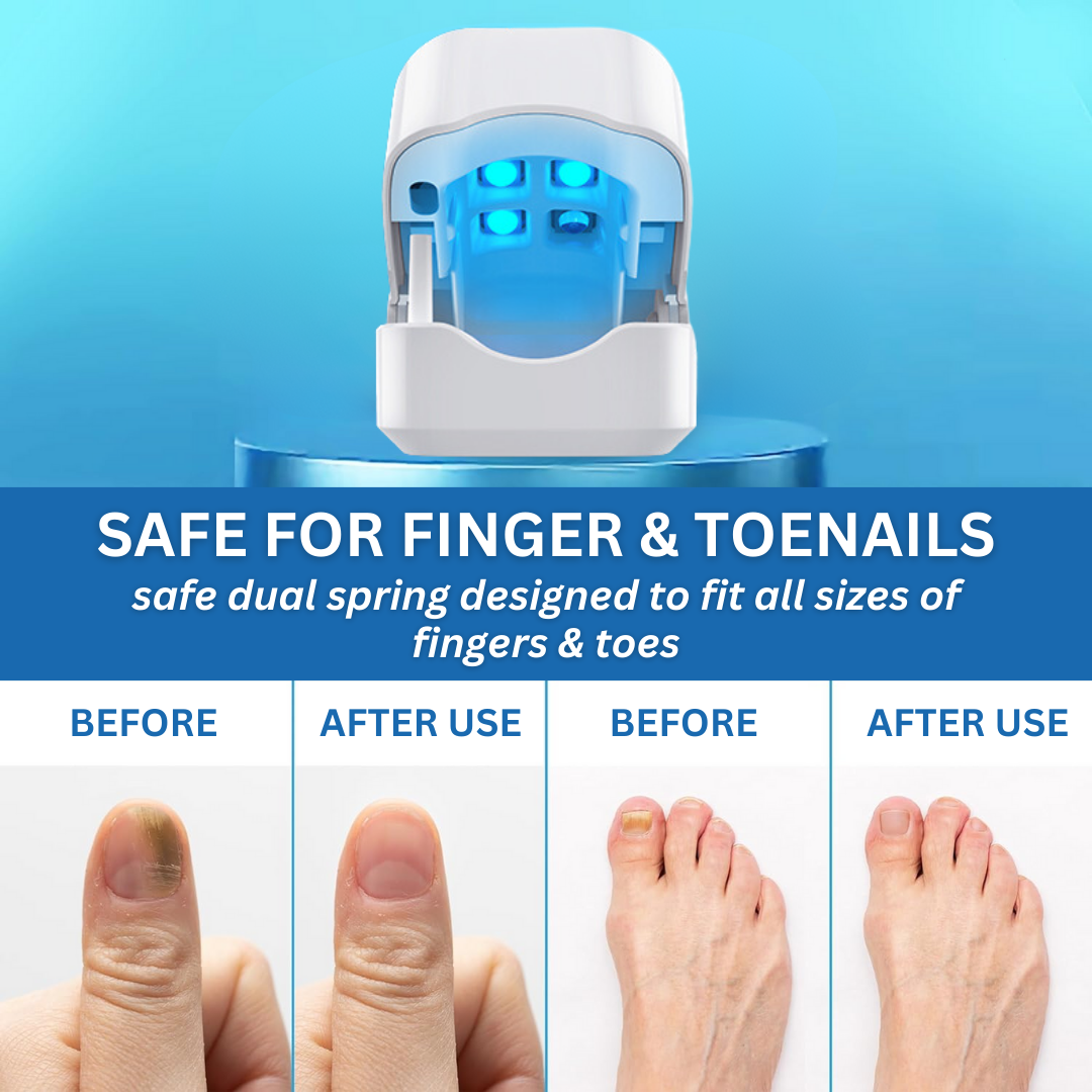 AEXZR™ Nail Fungus Laser Treatment Device