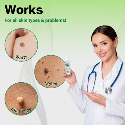 AEXZR™ Herbal Moles & Warts Removal Spray