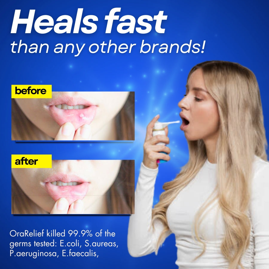 AEXZR™ Mouth Ulcer Spray