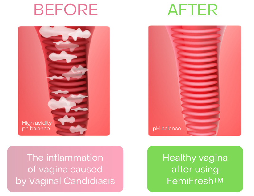 FemiFresh™ Vaginal Cleaning Patch