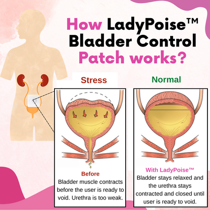 LadyPoise™ Bladder Control Patch