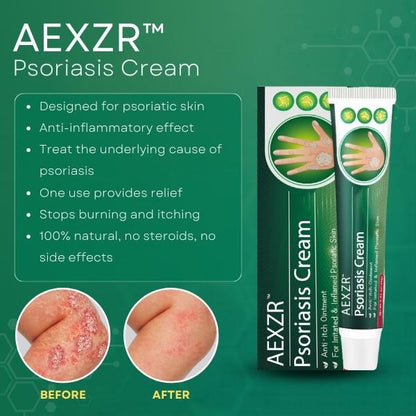 AEXZR™ Psoriasis Cream (Copy)