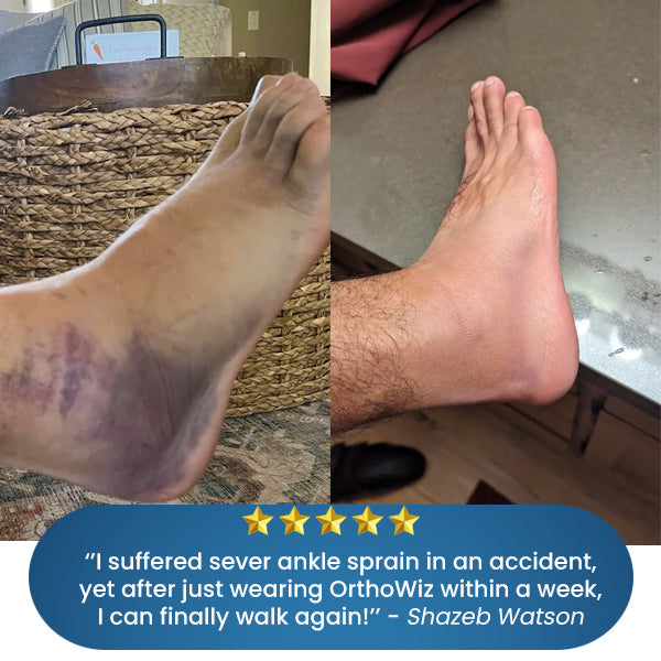 OrthoWiz™ Bone & Joint Pain Therapy Foot Brace