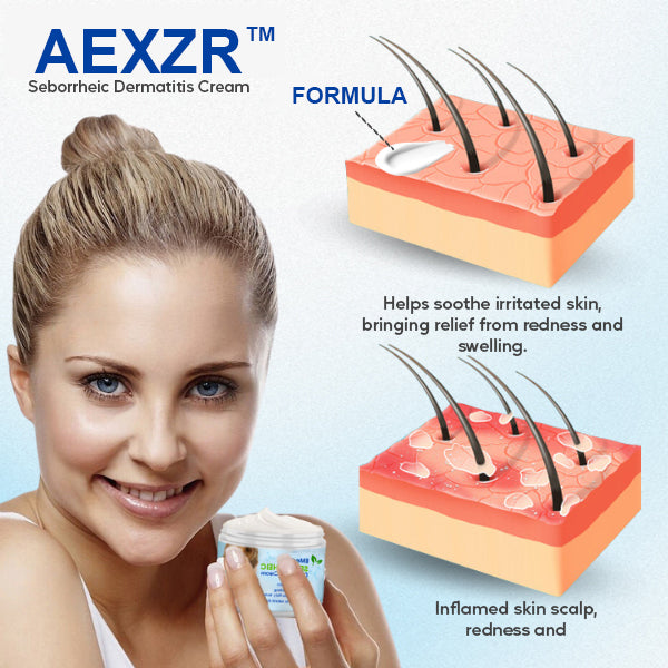 AEXZR™ Seborrheic Dermatitis Cream