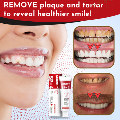 AEXZR™ SP-4 Whitening Probiotic Toothpaste